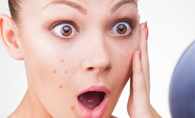 woman surprised to notice pimples on her face