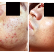 Photo #1: Beautify Your Skin