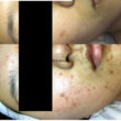 Photo #2: Beautify Your Skin