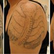 Photo #2: Discount Tattoo Removal