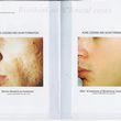 Photo #4: Bio-dermabrasion, Acne, Scars & Rejuvenation Facial