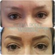 Photo #6: Derma Dolce. NATURAL Permanent MAKEUP!!