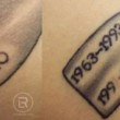 Photo #15: Renewal Laser Clinic - Best Tattoo Removal in Minnesota
