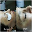 Photo #3: Eyelash Extensions Offer!