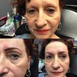 Photo #4: Eyelash Lift & Tint, Permanent Makeup & Eyelash Extensions