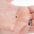 Photo #1: Bed bug treatments/ interior /exterior treatments - Best Prices