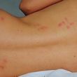 Photo #3: Bed bug treatments/ interior /exterior treatments - Best Prices