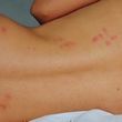 Photo #3: Bed bug treatments/ interior /exterior treatments - Best Prices
